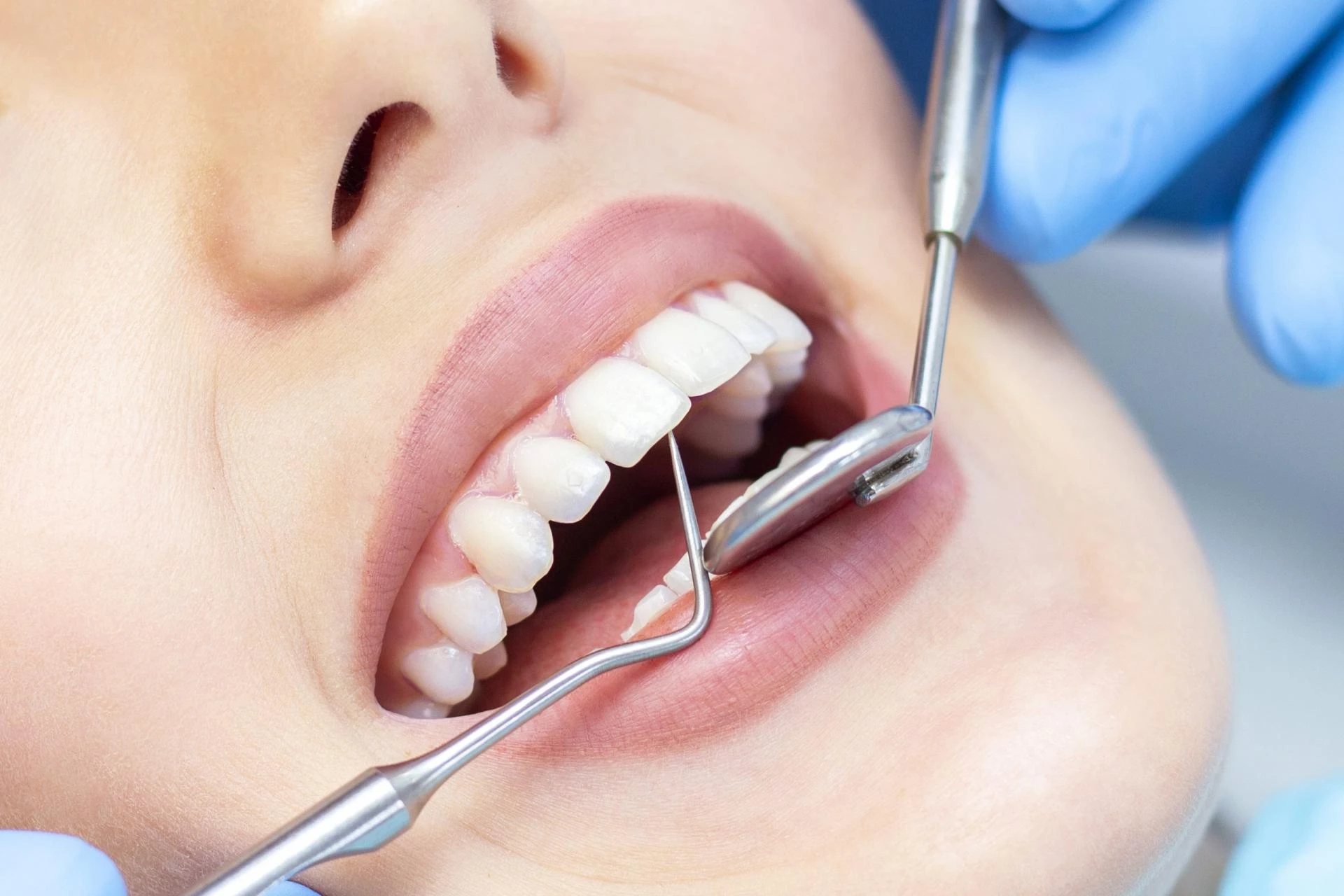 5 Reasons Cosmetic Dentistry Is Actually a Good Thing