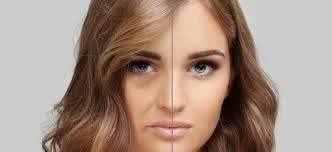 Urban Lifestyle And Increasing Skin Problems