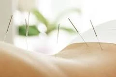 Comprehensive Guide Of Acupuncture For Erectile Dysfunction
