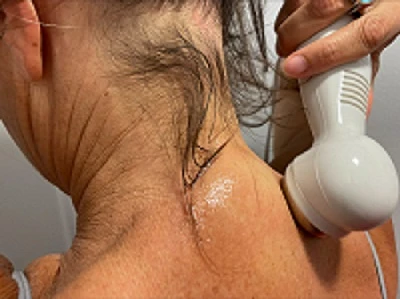 Effective Home Remedies to Get Rid of Neck Hump