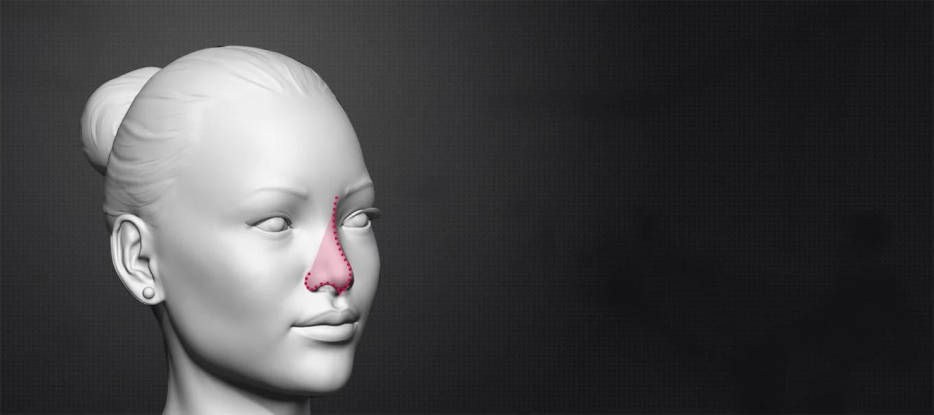 Debunking Myths and Misconceptions about Feminizing Rhinoplasty