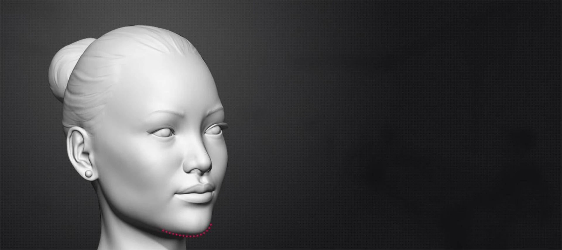 Affordable Chin Reduction Cost in India