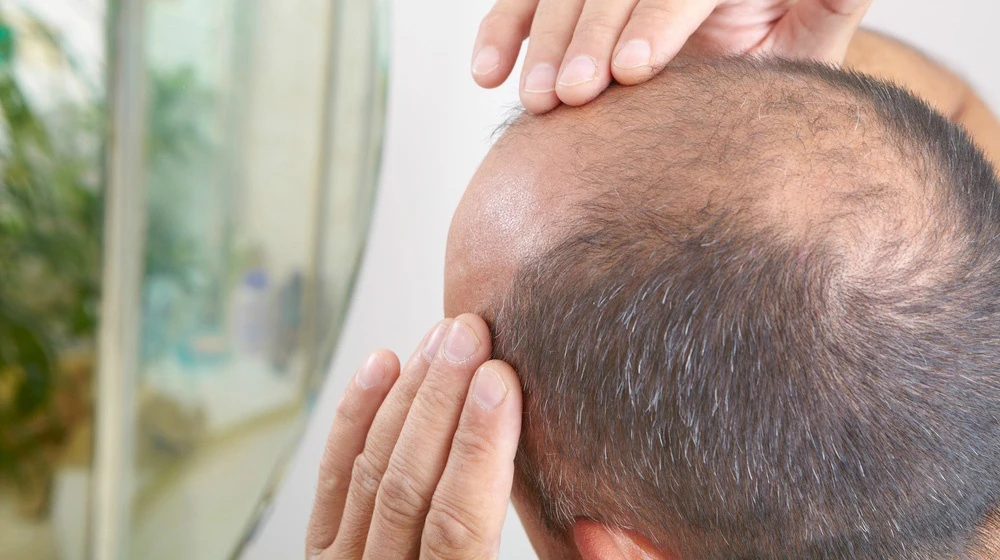 Revitalize Your Locks: Top Hair Fall Treatments in Dubai