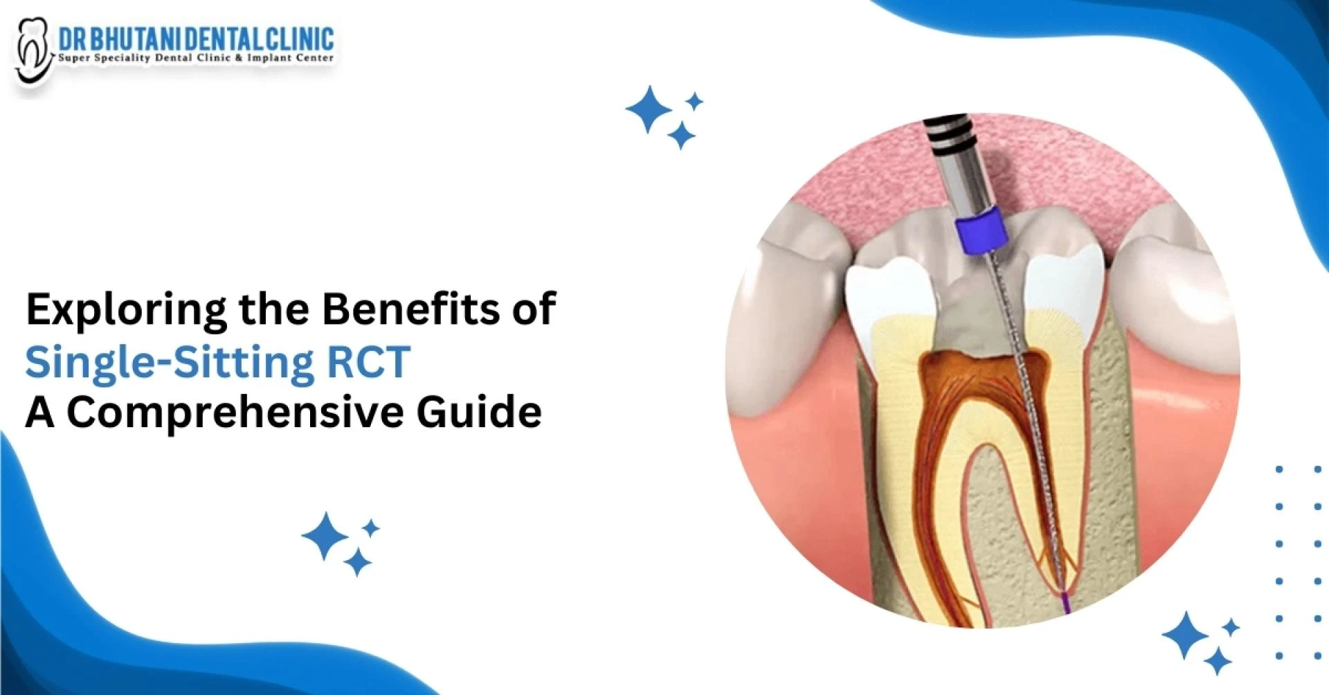 Exploring the Benefits of Single Sitting RCT A Comprehensive Guide