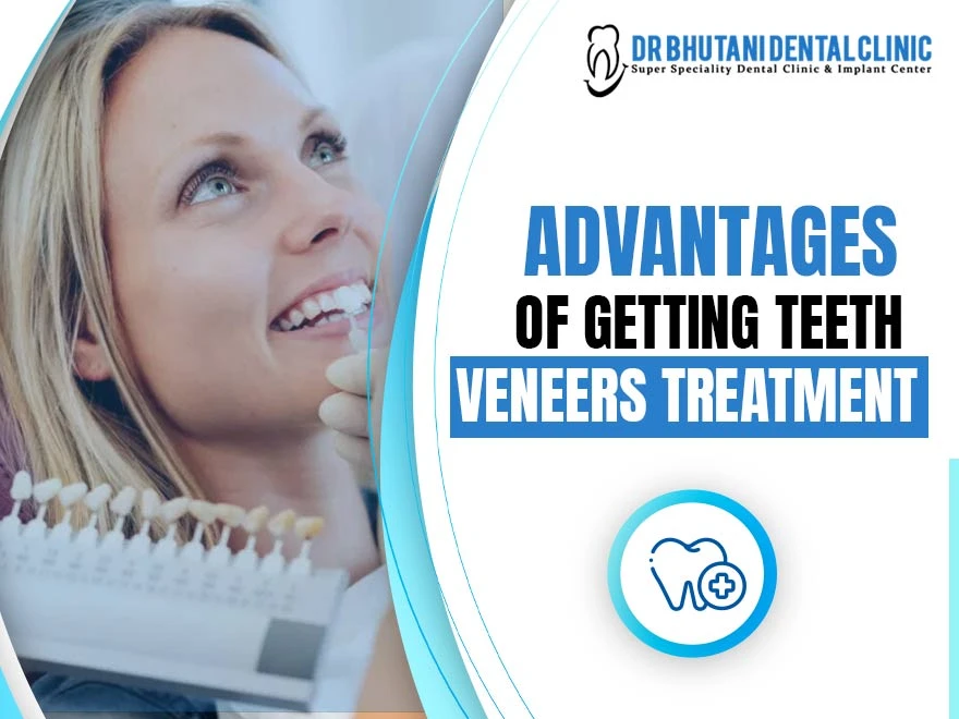 Advantages Of Getting Teeth Veneers Treatment