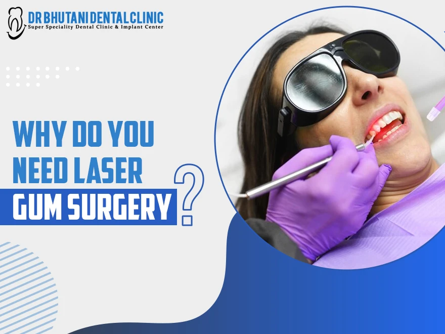 Why Do You Need Laser Gum Surgery?