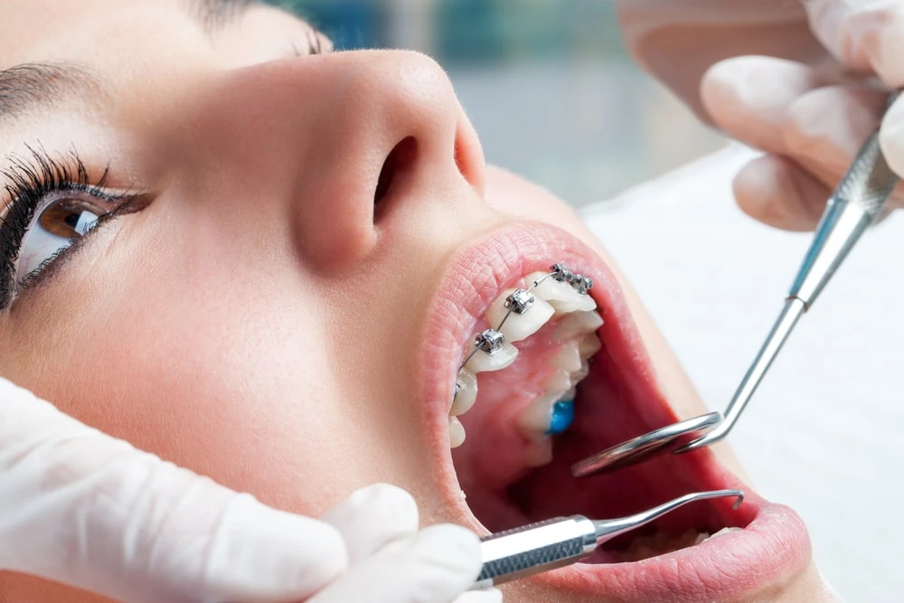 Unveiling Straight Smiles &amp; Expert Care: A Guide to Best Orthodontics Clinic &amp; Dentist in Dubai