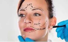 Do You Know What Are The Best Age For Facelift Surgery?