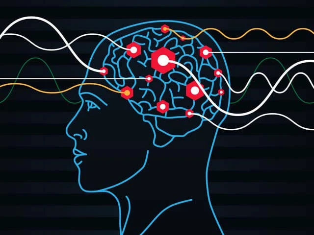 7 Informative Discussion Threads You Must Read Before Starting TMS