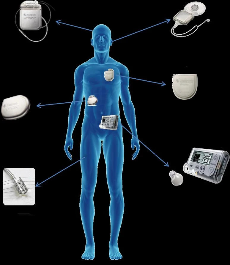 Implantable Medical Devices Market Outlook 2024, Size, Top Companies Share, Analysis and Forecast Till 2032