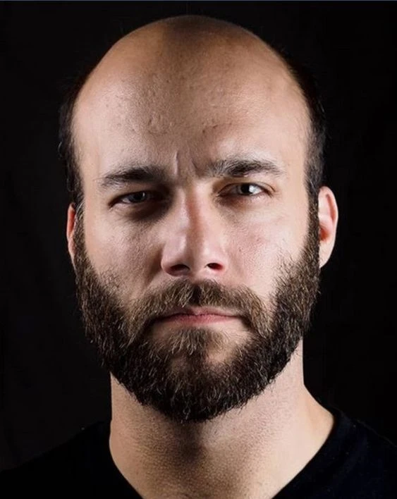 Regain Your Confidence: Hair Loss Solutions Classes Featuring Hair Systems