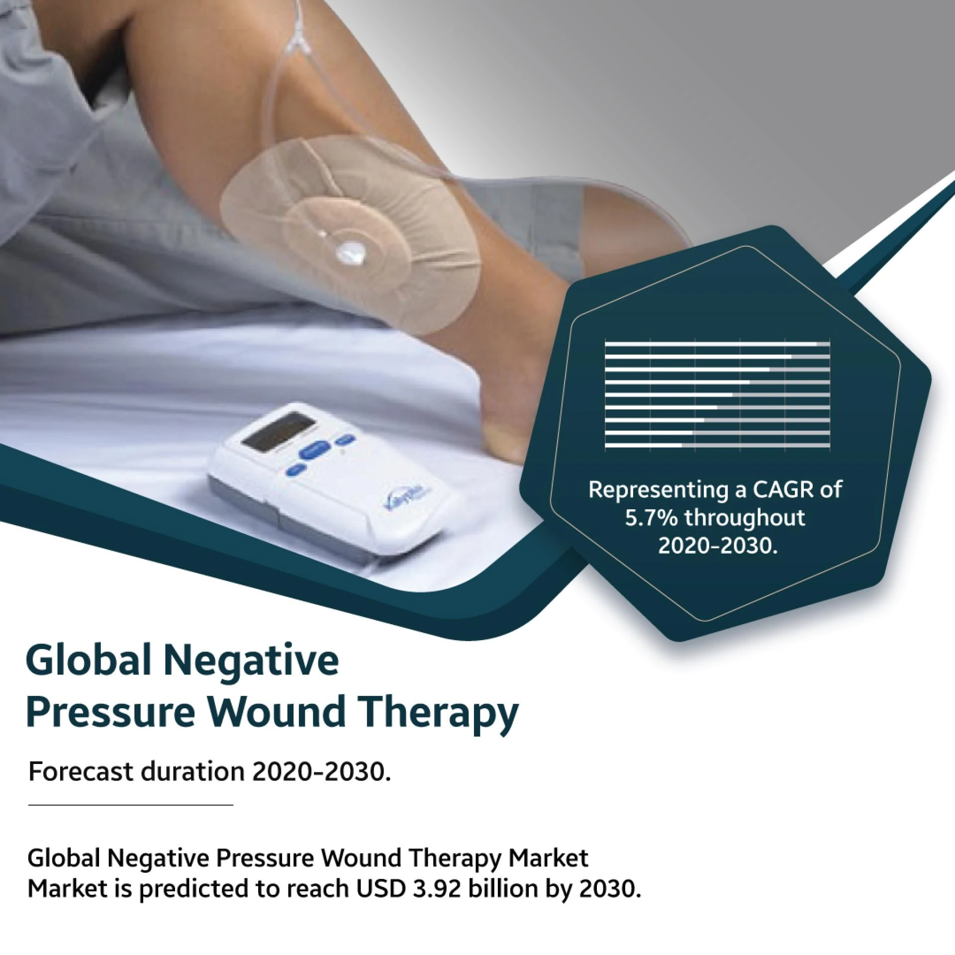 NEGATIVE PRESSURE WOUND THERAPY MARKET