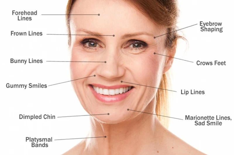 Dermal Fillers Market will exhibit a CAGR of around 8.275% for the forecast period of 2021-2028