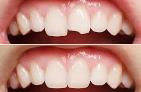 How to maintain your teeth and gums