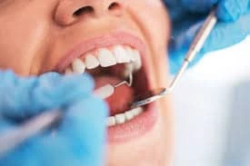 Four Reasons to Book a Regular Dentist Visit