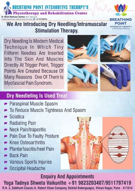 Dry Needling and Cupping Therapy in Viman nagar