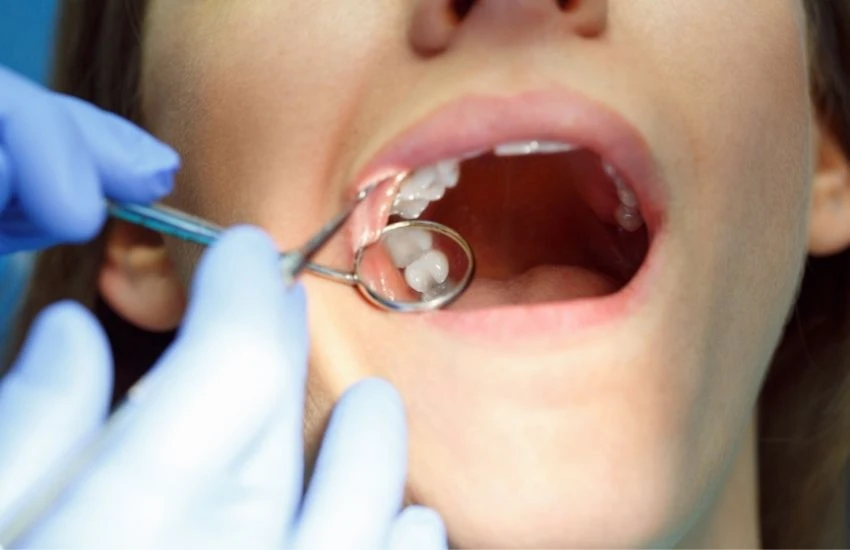 Detailed Guide to Dental Implants in Los Angeles!