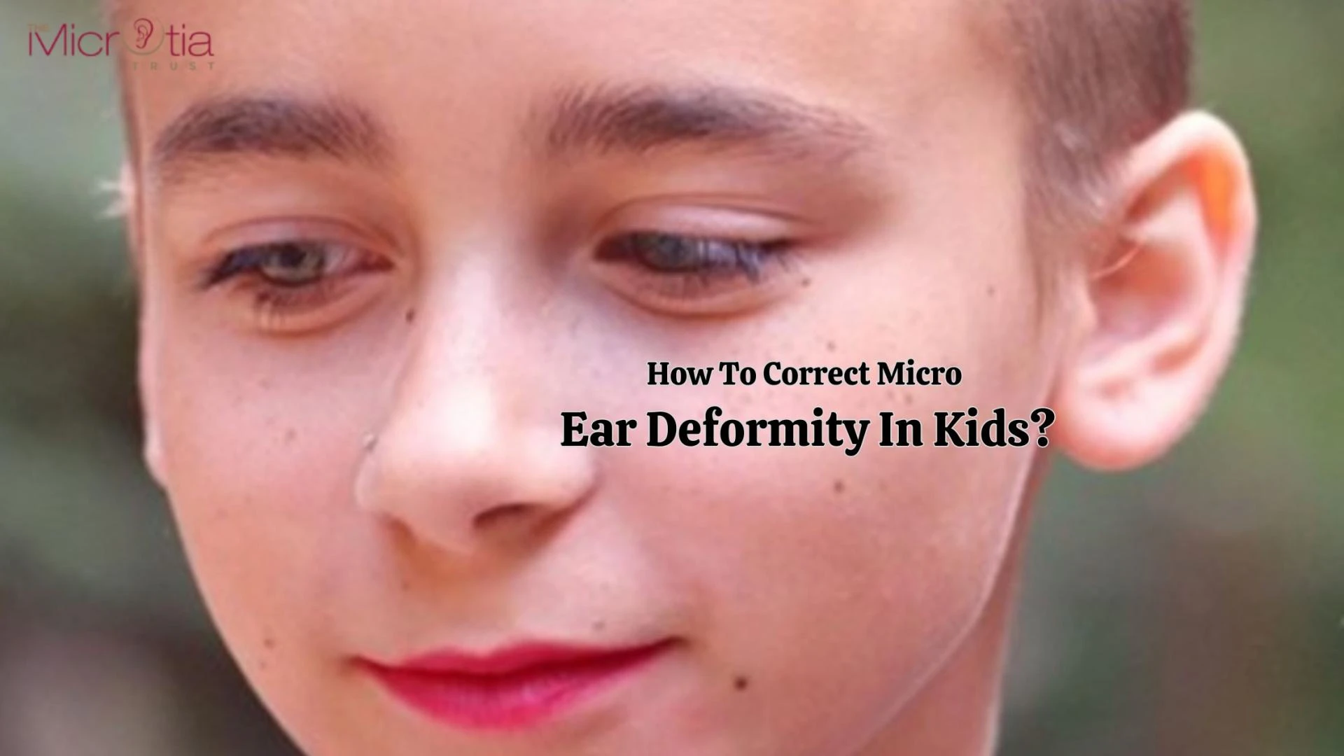 How To Correct Micro Ear Deformity In Kids?
