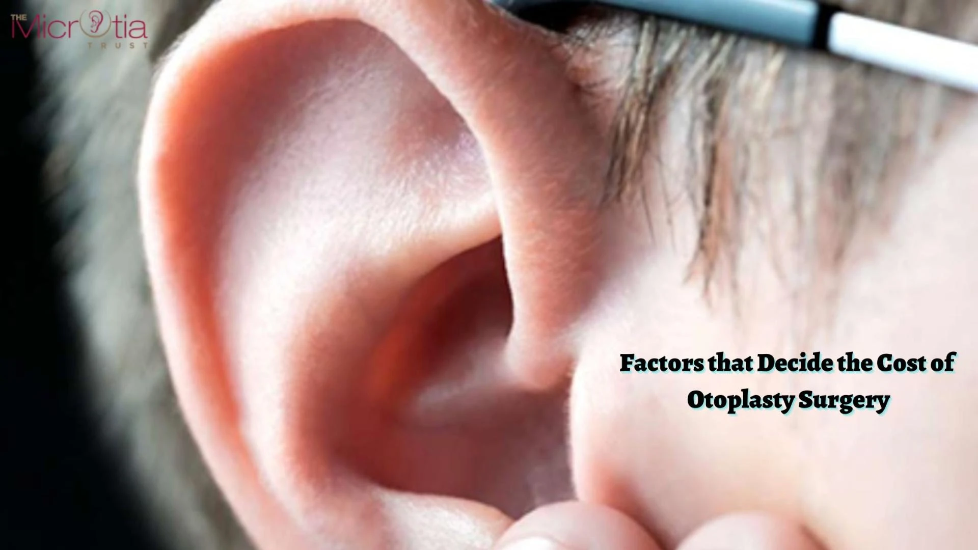 Factors that Decide the Cost of Otoplasty Surgery