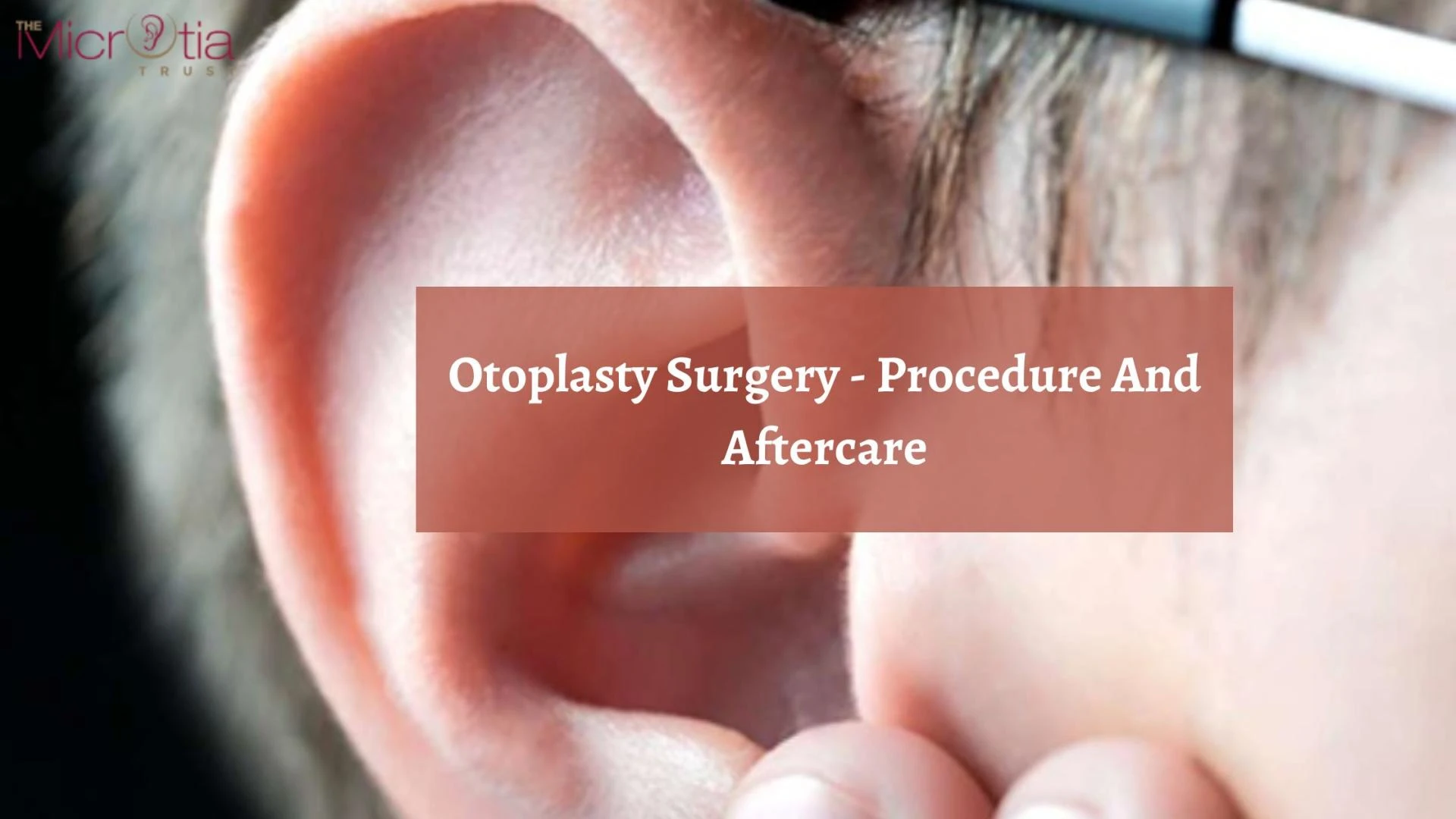 Otoplasty Surgery - Procedure And Aftercare
