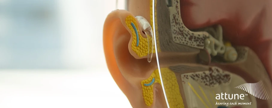 Hearing Impairment Online