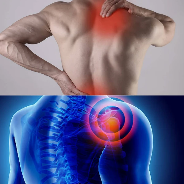 Why my Muscle Pain - Treatment, Medicine, Types