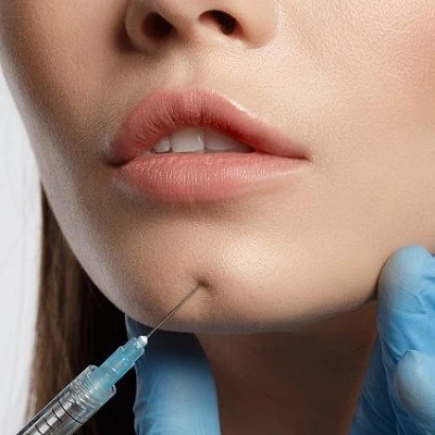 Elegance Redefined: Sculptra Fillers Clinic in Oman