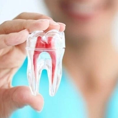 Root Canal and Oral Health: The Ripple Effect