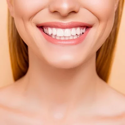 Transform Your Smile: Hollywood-Style Makeover