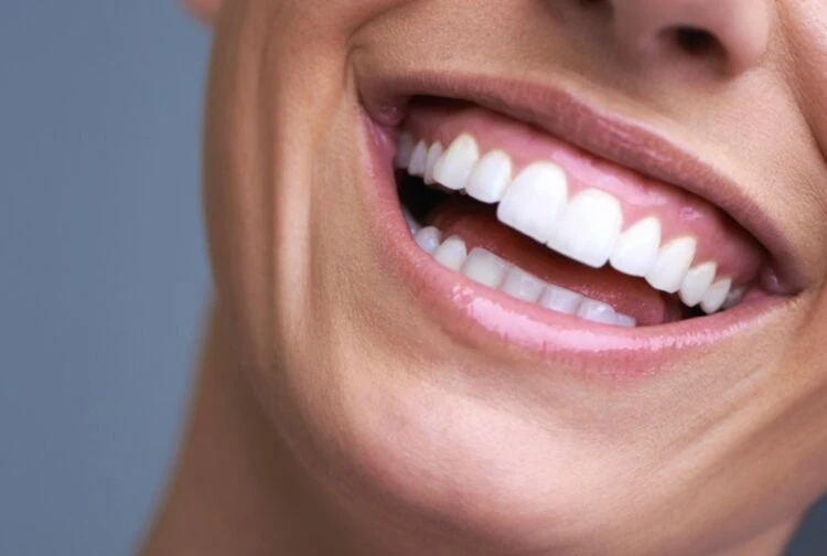 Hollywood Smile Design: A Celeb-Approved Dental Trend