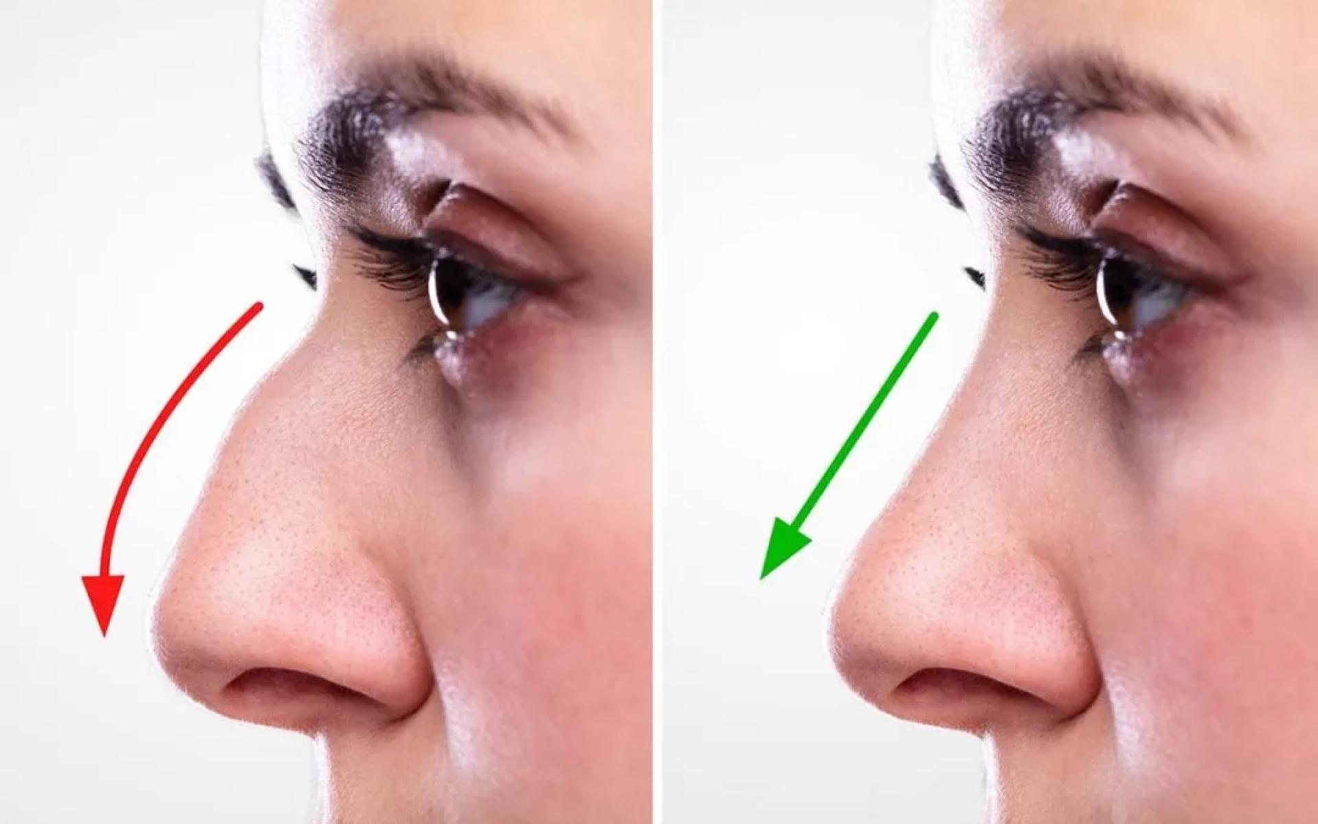 Discovering the Beauty of Rhinoplasty