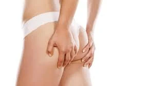 Booty Transformation: The Art of Buttock Augmentation