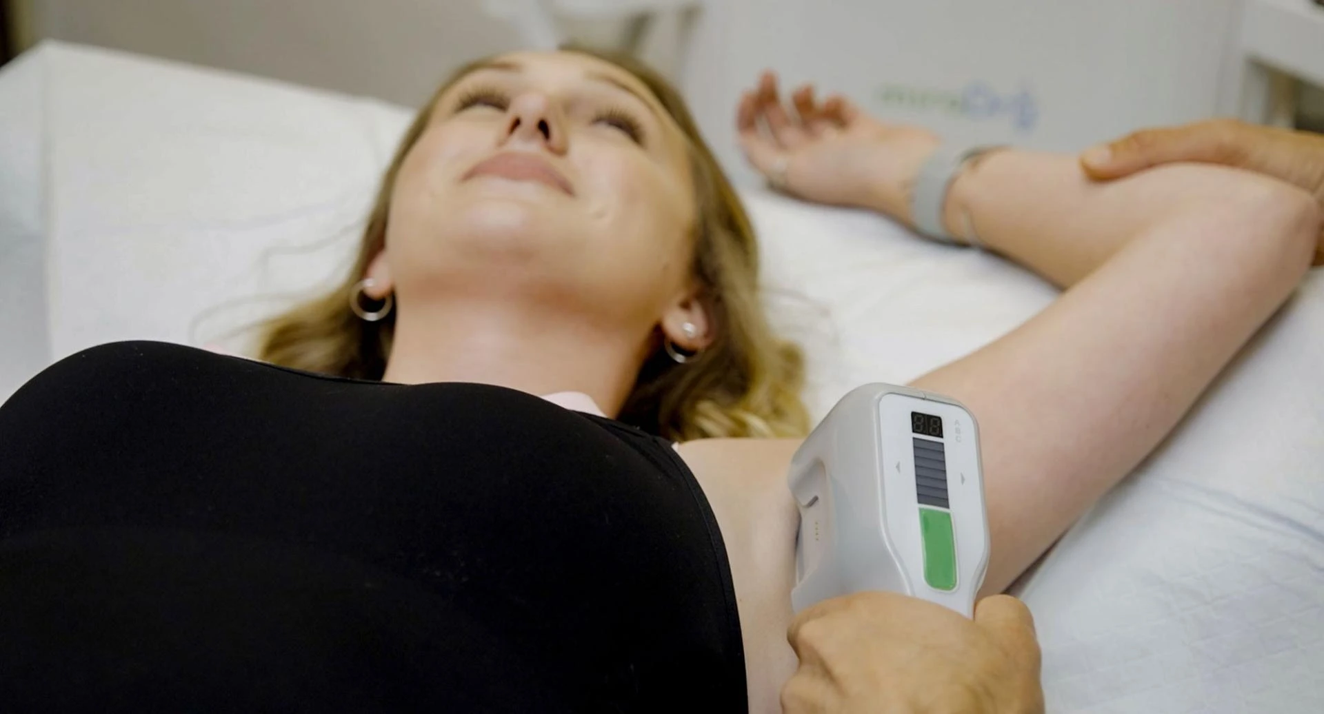 Bye-Bye Sweat Stains: Miradry Treatment Unleashed