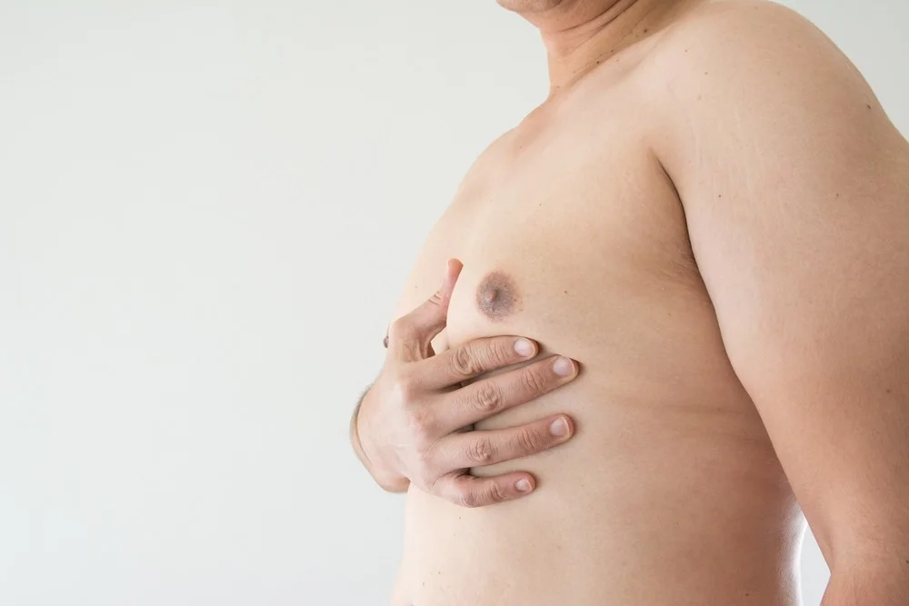  Gynecomastia Surgery: Is It the Right Option for You?