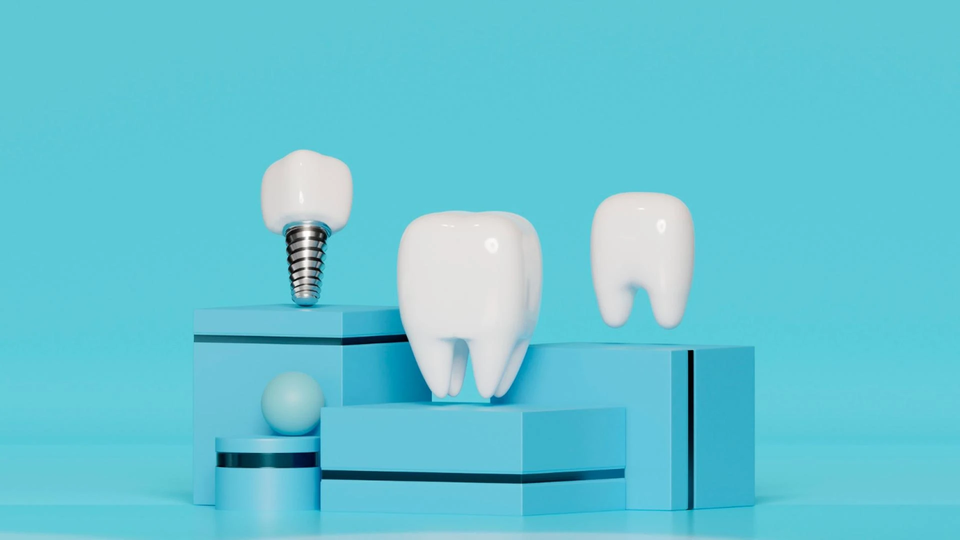 How do I find a reputable dental implant provider near me?