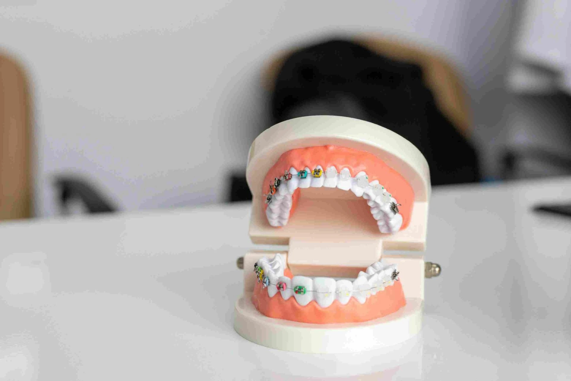 What You Need to Know Before Using Braces