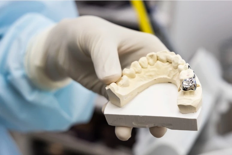 How to Maintain Your Dental Crown in League City: Tips and Best Practices