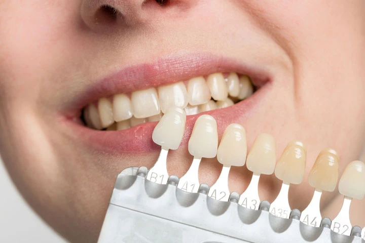 Cosmetic Dentistry Market Analysis, Growth rate, Global Trends, Price and Forecasts to 2028