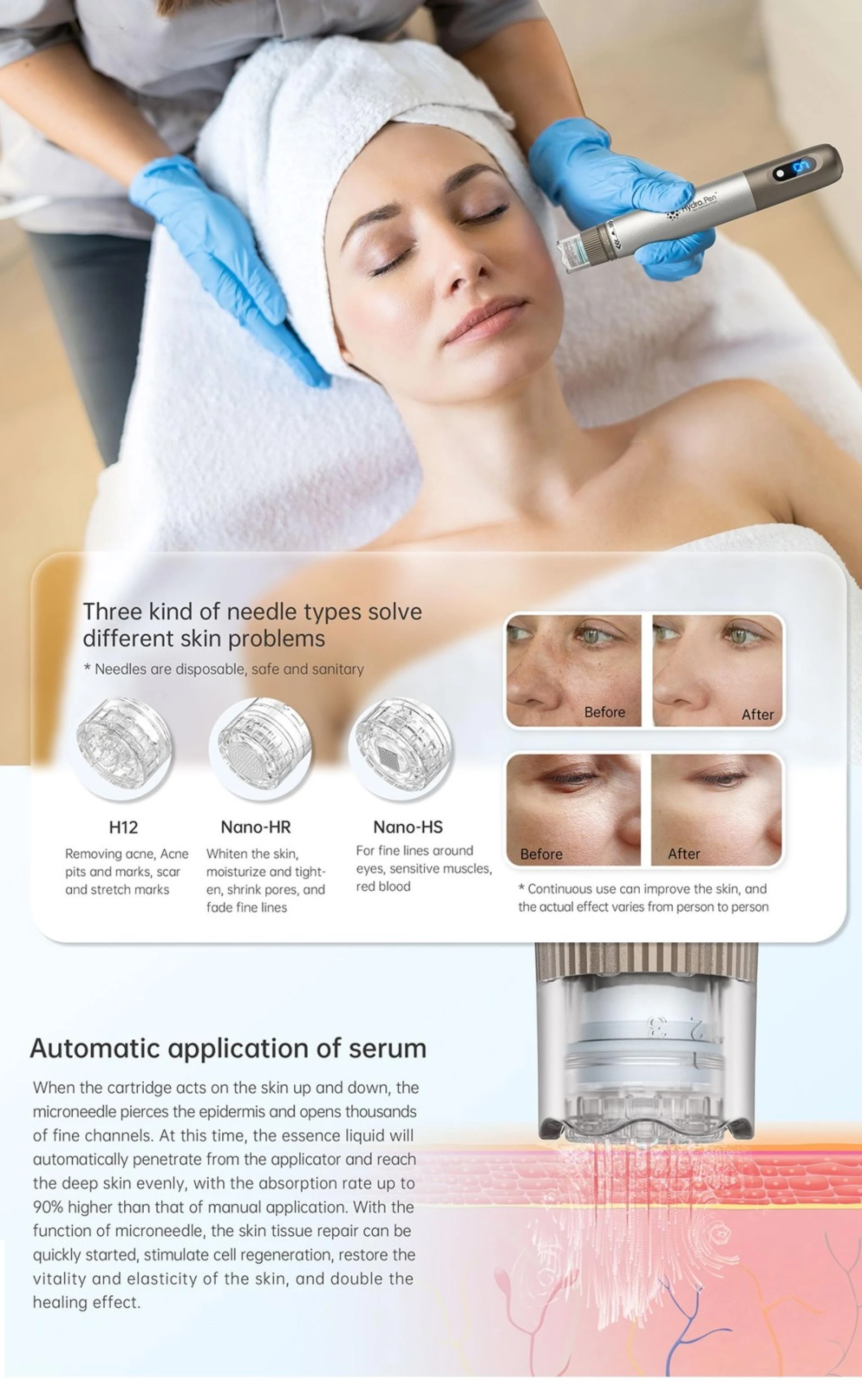 Unveiling The Secret to Radiant Skin: Hydra Pen H3 Microneedling Device