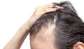 Linea De Cabello