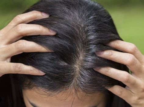 How to Deal with Premature Greying: Tips for Maintaining Healthy Hair