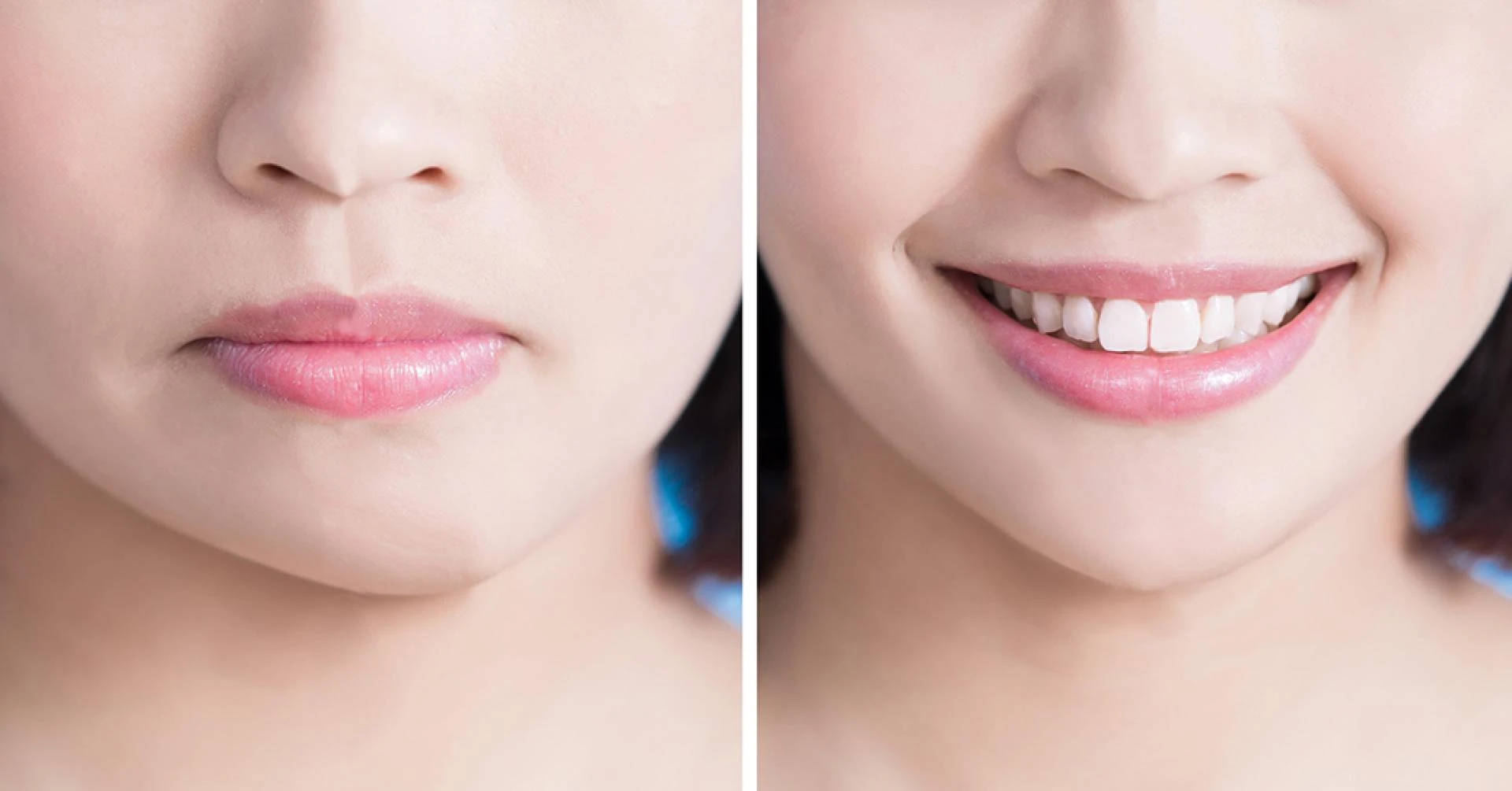 How To Lose Weight In Your Face: 7 Effective Recommendations