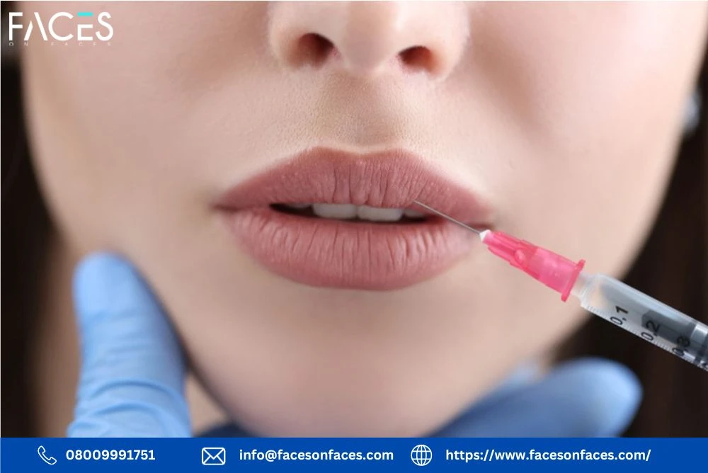 Lip Filler Course in London: Learn from the Best