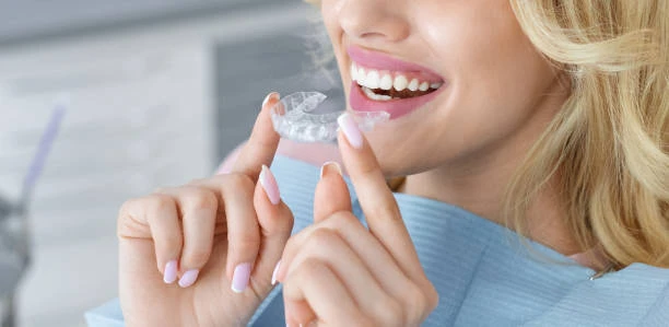 How Long Does Invisalign Treatment Take? Understanding the Timeline in Birmingham