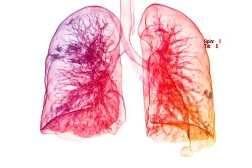 What are various respiratory distress syndrome treatment available in market today?
