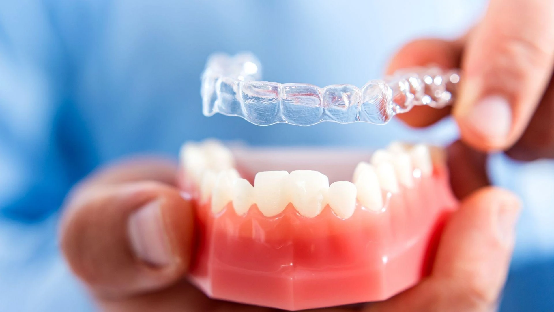 Common Myths and Misconceptions About Dental Aligners