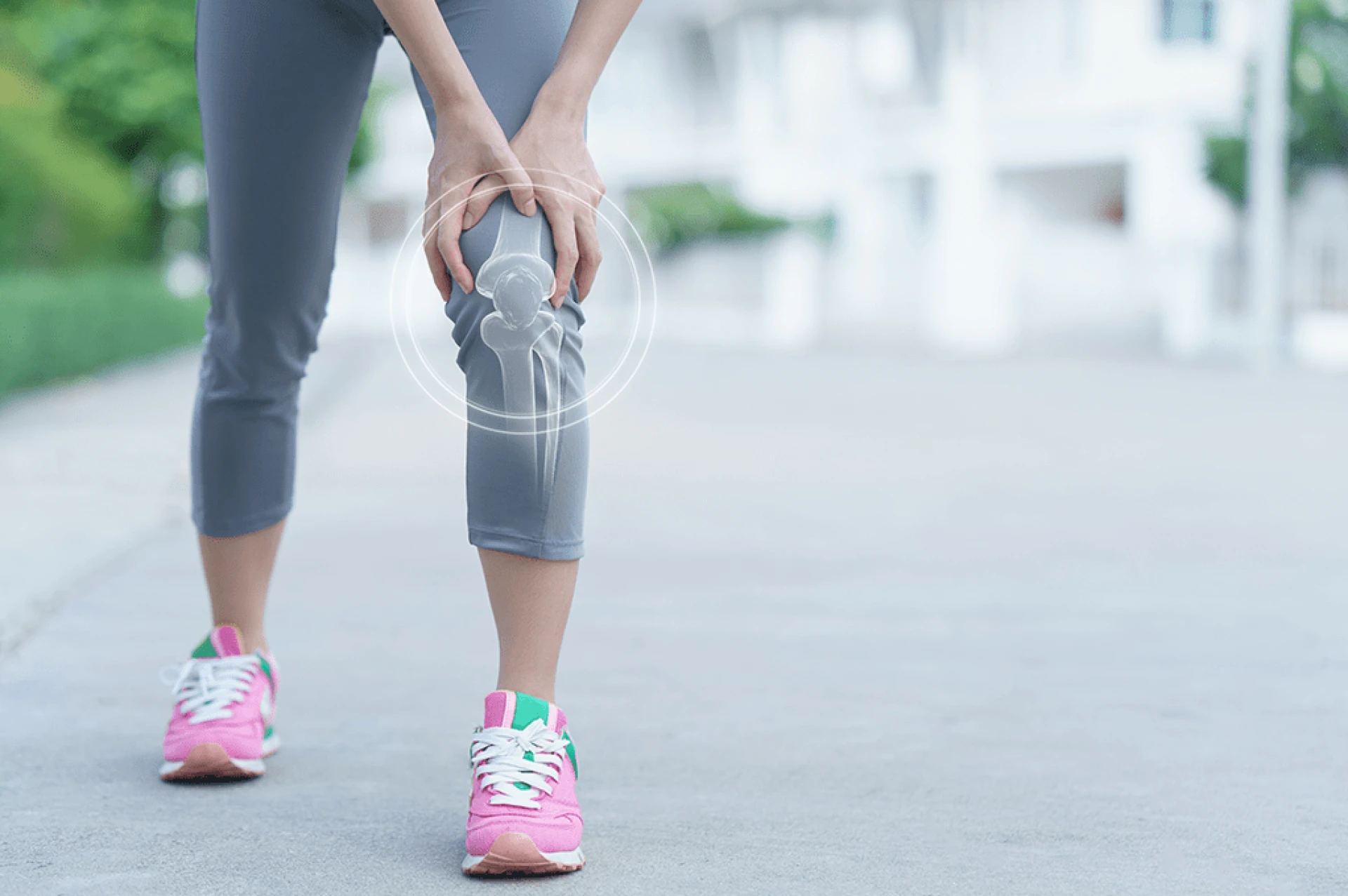 Understanding the Iliotibial Band Friction Syndrome