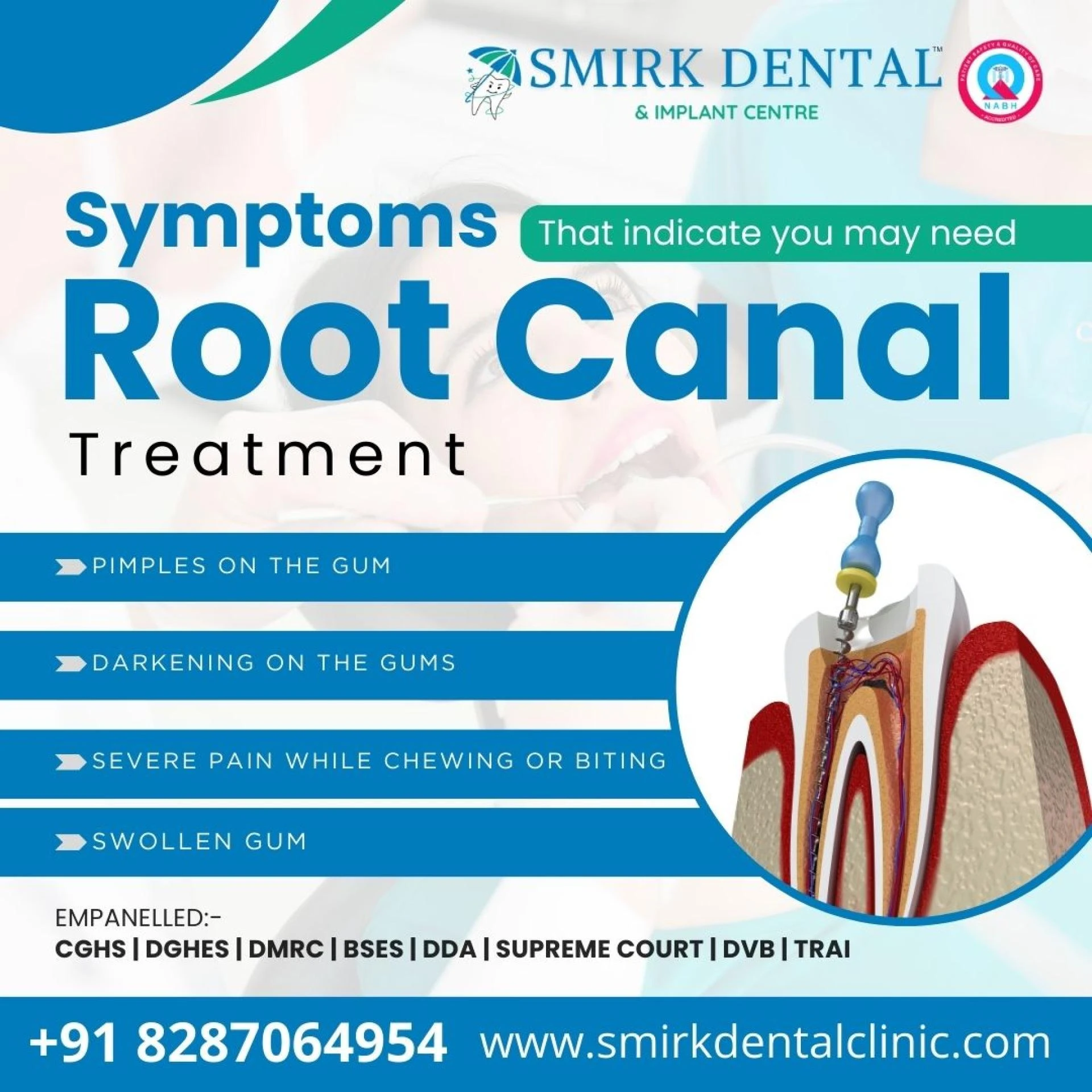 Exploring Root Canal Treatment: Reasons and Types of Treatment Offered by Root Canal Doctors in Delhi