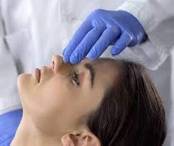 procedure of Rhinoplasty treatment