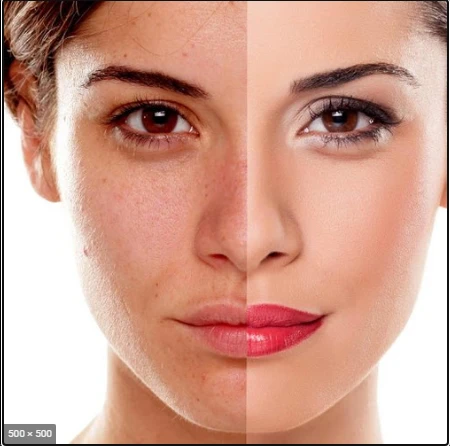 Costly Skin Pigmentation Treatments Rivaled By Cheap Natural Skin Whitening Ingredients